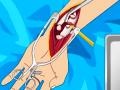Oyun Arm surgery 2