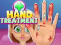 Oyun Hand Treatment