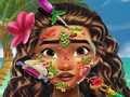 Oyun Moana Skin Doctor
