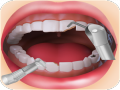 Dentist oyun 